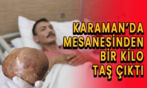 Karaman’da hastanın mesanesinden 1 kilo taş çıktı